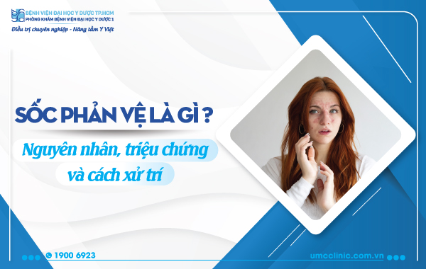 SỐC PHẢN VỆ LÀ GÌ? NGUYÊN NHÂN, TRIỆU CHỨNG VÀ CÁCH XỬ TRÍ