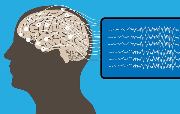 Đo điện não đồ (EEG) để chẩn đoán rối loạn giấc ngủ