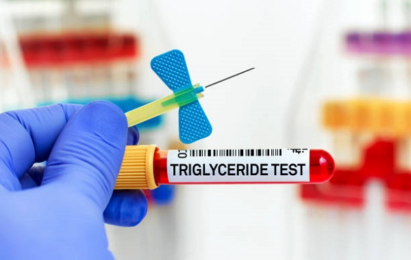 Tìm hiểu xét nghiệm định lượng triglycerid