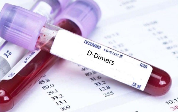 Xét nghiệm D-Dimer là gì?